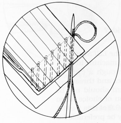 Illustration of the path of the needles and threads in oversewing.
